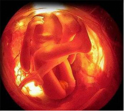 懷孕生男生女早…