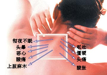 人體頸椎24小時(shí)保養(yǎng)法
