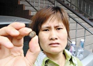 六歲女童下體被塞入電池