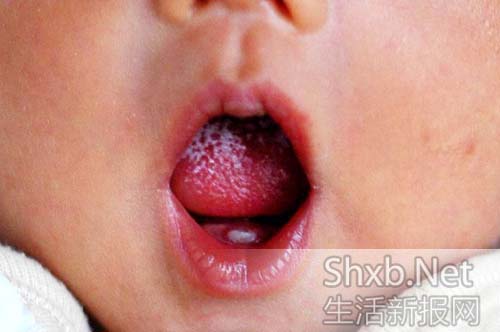 新生寶寶長出一顆小白牙