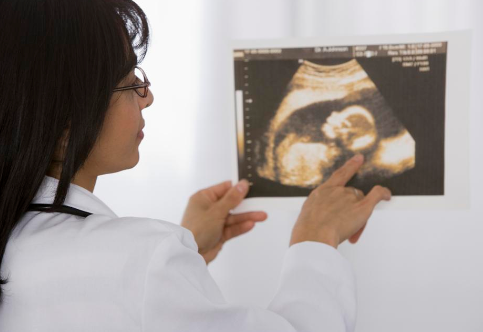 臍帶繞頸怎么辦