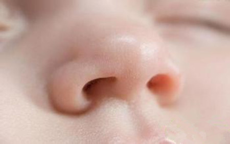 新生兒鼻塞鼻屎多怎么辦