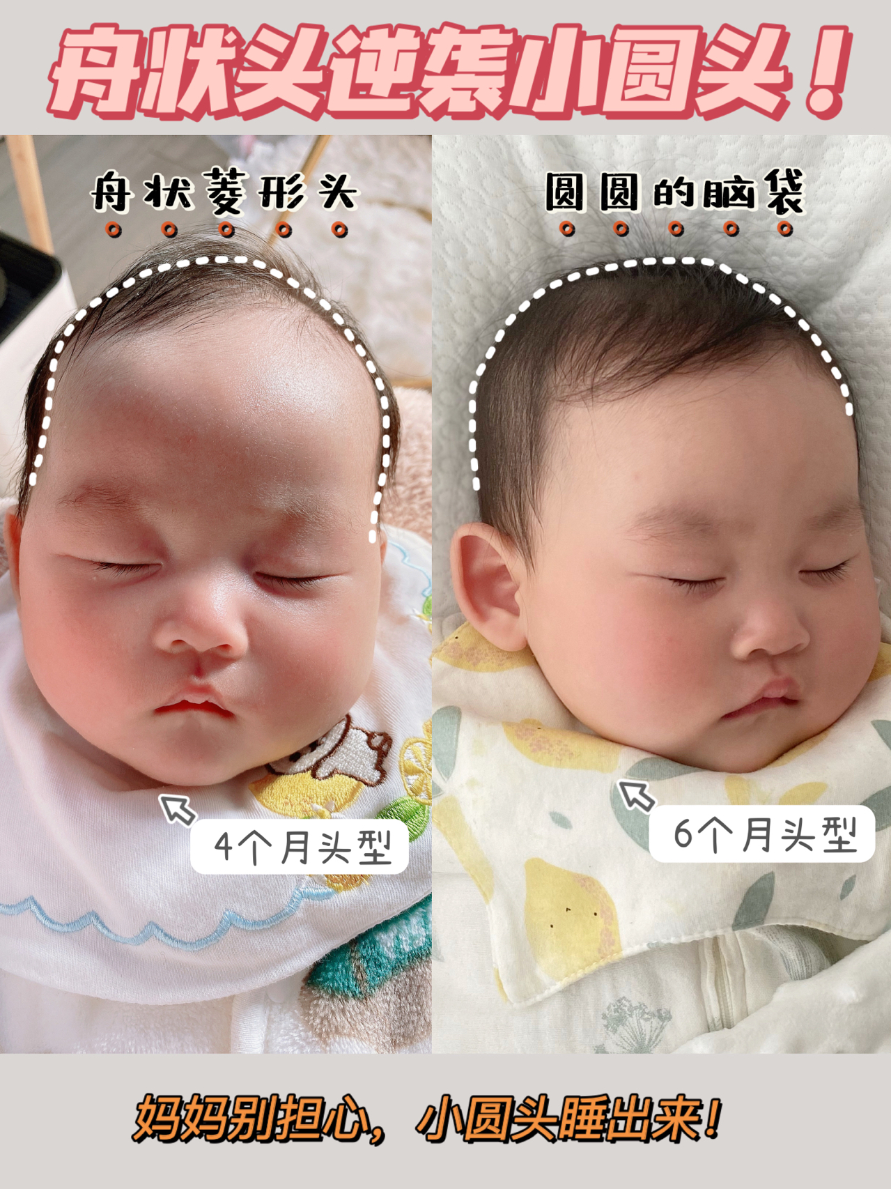 成功逆襲！盤狀頭睡出小圓頭，只需要這樣做！