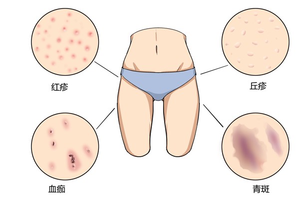 喀什男科醫院哪家最好？喀什曙光看男科怎么樣？